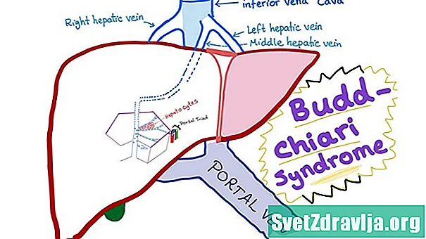 ¿Qué es el síndrome de Budd-Chiari? - Salud