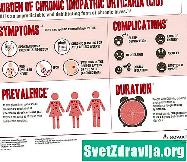 Wat is chronische idiopathische urticaria en hoe wordt het behandeld?