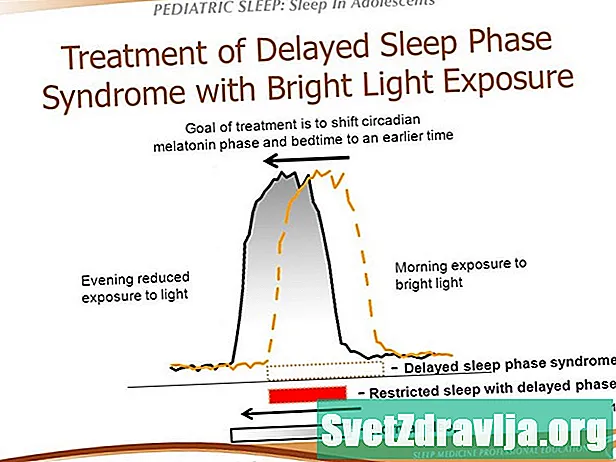 Whatfarë është sindroma e fazës së gjumit të vonuar? - Shëndetësor