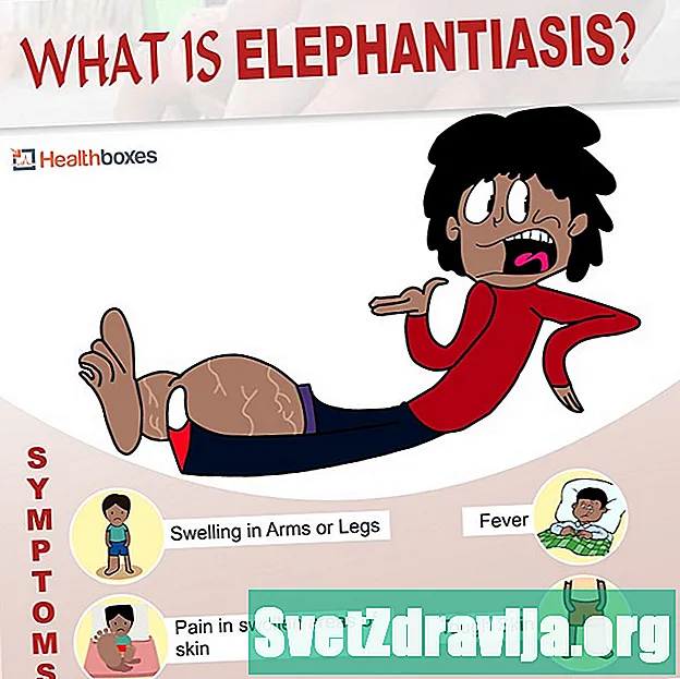 Mis on elephantiasis?