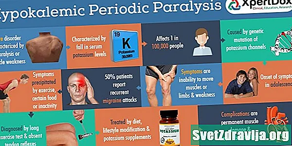 Što je hipokalemička periodična paraliza i kako se liječi? - Zdravlje