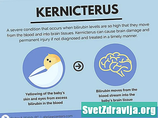 Čo je liek Kernicterus? - Zdravie