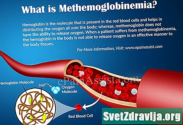 Kaj je methemoglobinemija?