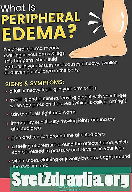 ¿Qué es el edema periférico y qué lo causa? - Salud