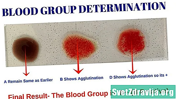 Vad är den A-positiva blodtypsdieten? - Hälsa