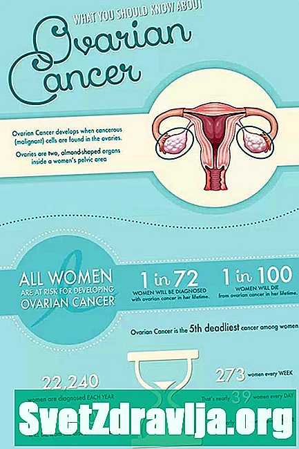 Što treba znati o recidivu raka jajnika - Zdravlje