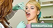Kaj morate vedeti o krvavitvi dlesni