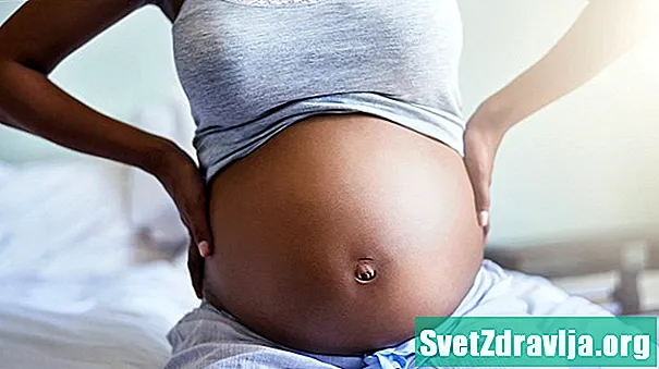 Što trebate znati o pupčanim hernijama tijekom i nakon trudnoće
