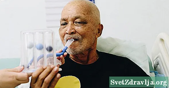 Wat u moet weten over het gebruik van een incentive-spirometer voor longsterkte