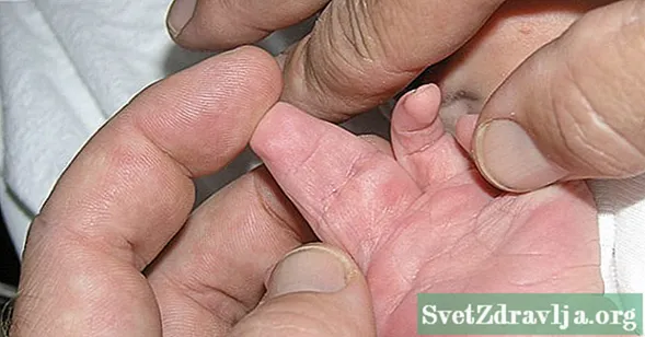 Ce trebuie să știți despre degetele și degetele de la picioare