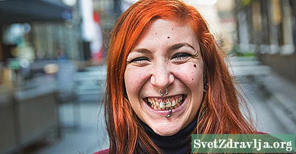Hva du bør vite før du får en Smiley Piercing - Velvære