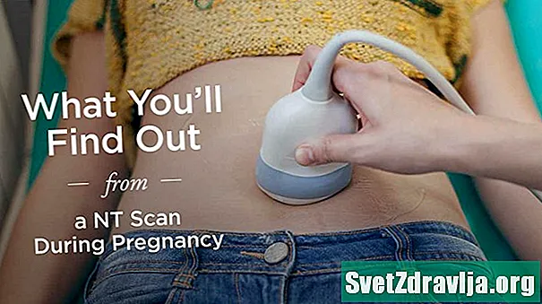 Vad du får reda på från en NT-skanning under graviditeten