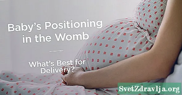 موقعیت کودک شما در Womb چیست