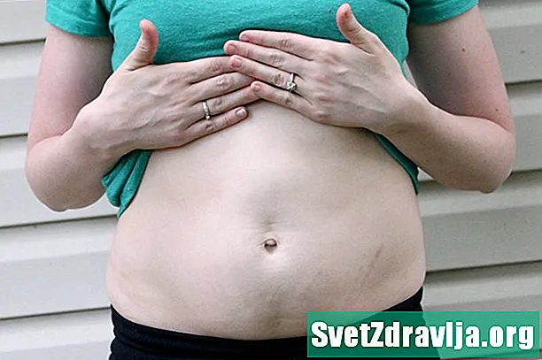 腹部の膨らみの原因とその治療法