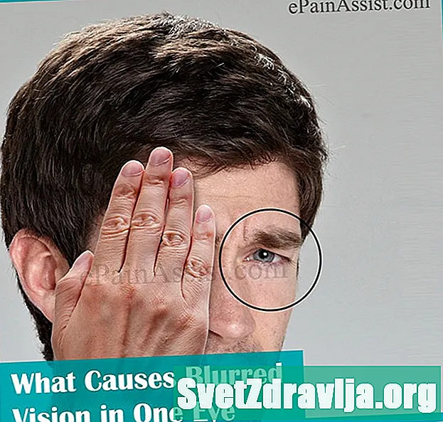 Kaj povzroča zamegljen vid?