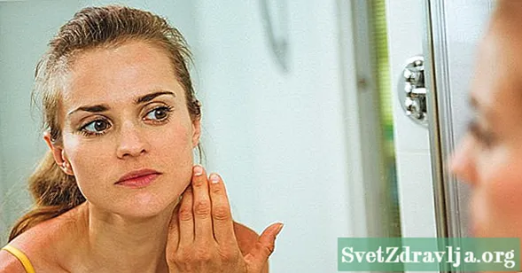 Mi okozza az arcom duzzadását? - Wellness