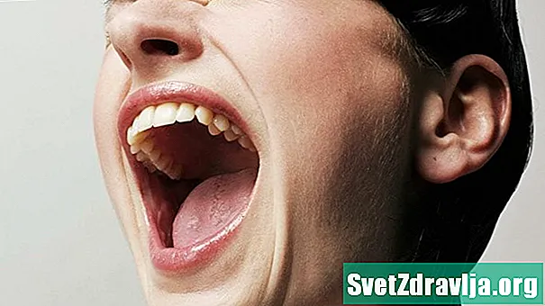 Čo spôsobuje svrbenie v ústach? Príčiny, príznaky a liečby, od alergií po infekciu kvasinkami - Zdravie