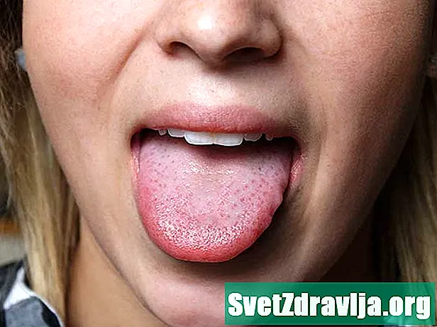 Vad orsakar min ömma tunga?