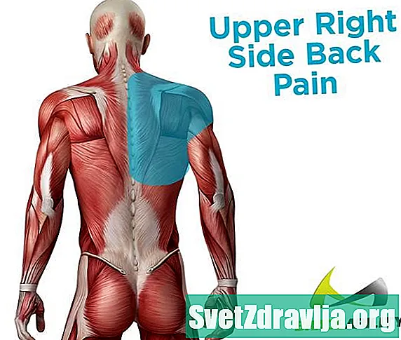Điều gì gây ra đau lưng trên bên phải của tôi và làm thế nào để tôi điều trị nó? - SứC KhỏE