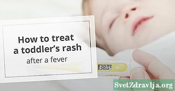 چه زمانی نگران راش بعد از تب در کودکان نوپا باشید