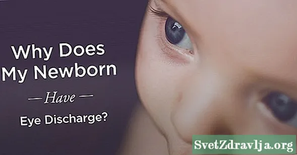 Зашто моје новорођенче има испуштање ока?