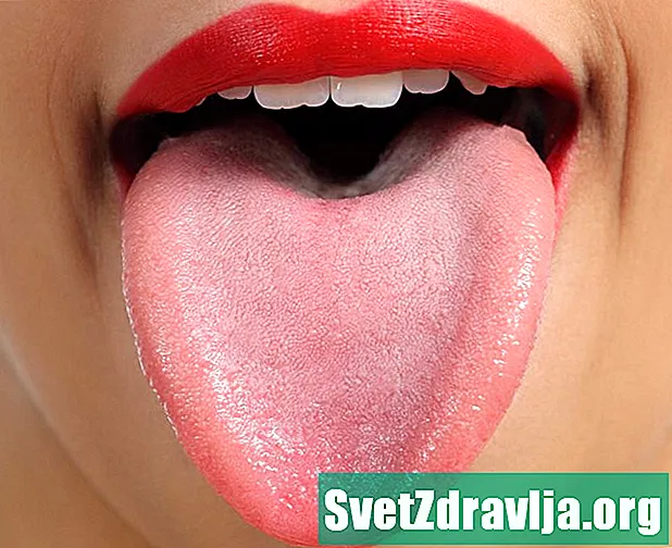 为什么我的舌头上有紫色或蓝色斑点？