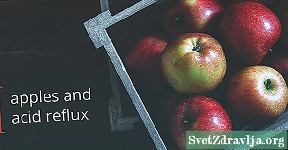 Pomůže vám jíst jablka, pokud máte kyselý reflux? - Wellness