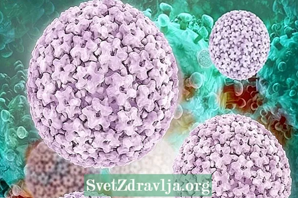 Zopeka 10 zowona za HPV