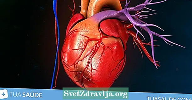 10 Haaptsymptomer vun Häerzinfarkt