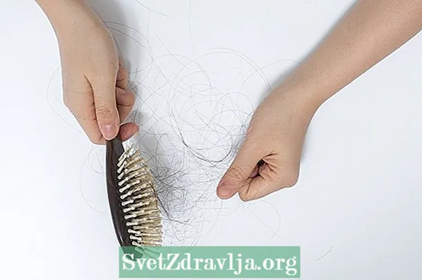 5 Tipps zur Verhinderung von Haarausfall