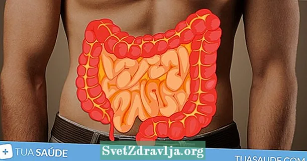 6 sintomi di gas (stomaco e intestinale)