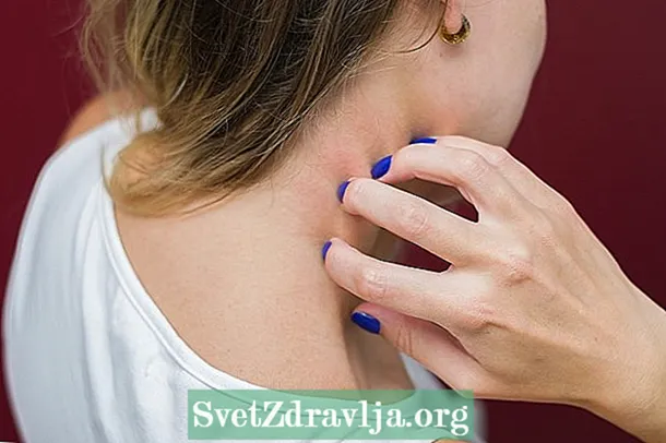 7 ādas niezes cēloņi un kā rīkoties