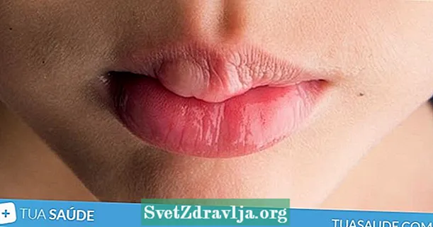 7 shkaqet kryesore të fryrjes së gojës dhe çfarë të bëni
