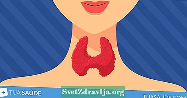 7 nga punoan nga simtomas sa kanser sa thyroid