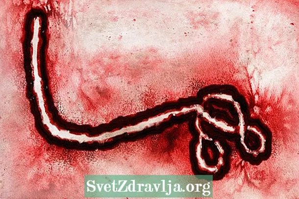 7 glavnih simptomov ebole