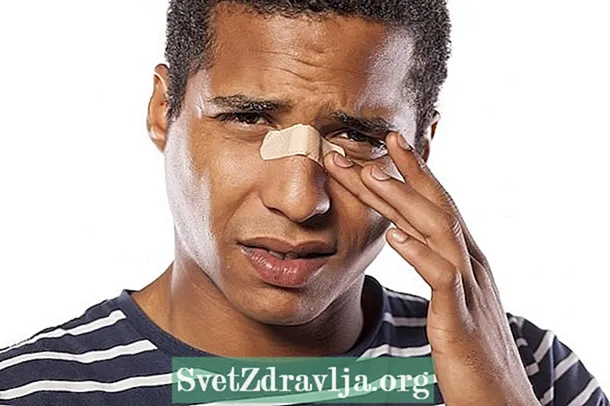 8 causas de sangrado nasal e como tratala