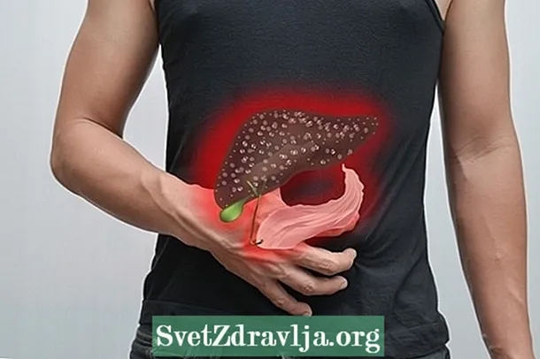 8 glavnih vzrokov za jetrno maščobo