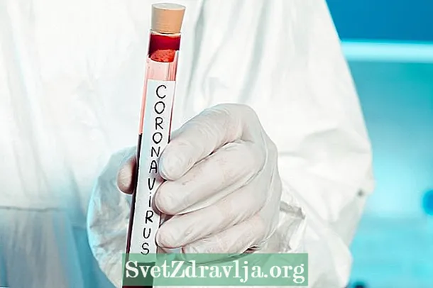Iimpawu zokuqala ezili-9 zecoronavirus (COVID-19)