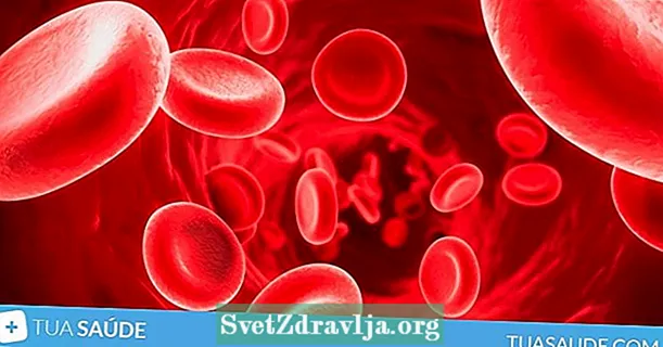 9 síntomas de anemia y cómo confirmarlos