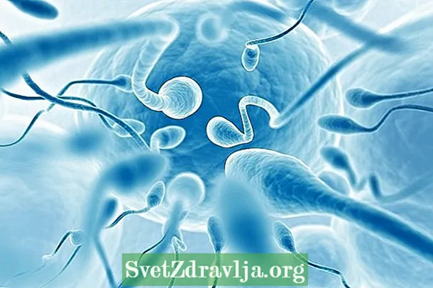 Alergia na spermie (spermie): príznaky a spôsob liečby - Vhodnosť