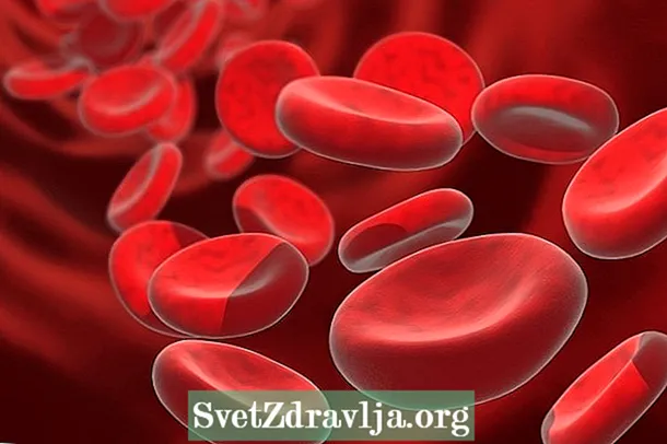 Anemia hemolitik: apa, gejala utama lan perawatan