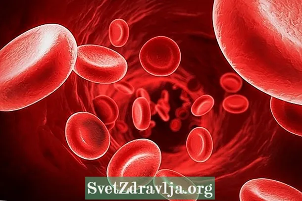 Sideroblastic 빈혈 : 그것이 무엇인지, 증상, 원인 및 치료 - 적합