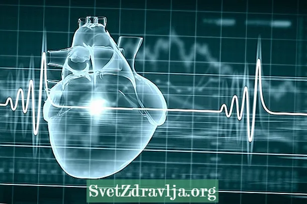 Sydämen rytmihäiriöt: mikä se on, oireet, syyt ja hoito - Kunto