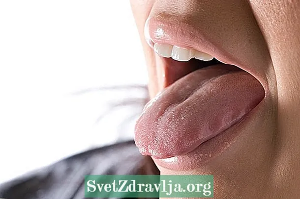 Polka-prickar på tungan: vad kan vara och vad man ska göra
