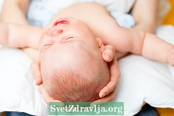 Baby botulisme: hva det er, symptomer og behandling
