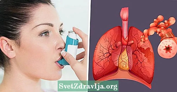 Astmatiskais bronhīts: kas tas ir, simptomi un ārstēšana - Piemērotība