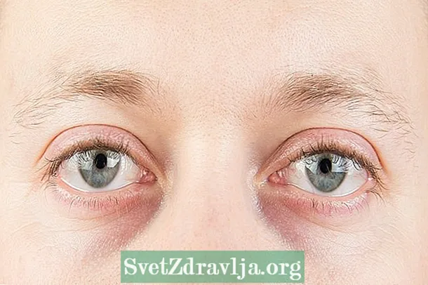 Karboksyterapia na cienie pod oczami: jak to działa i konieczna pielęgnacja