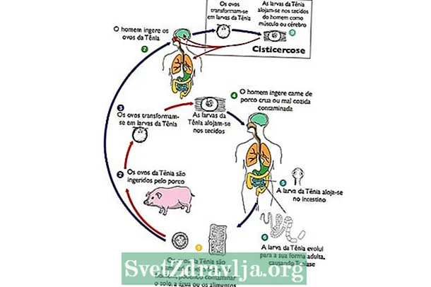 Цистицеркоза: шта је то, симптоми, животни циклус и лечење - Фитнес