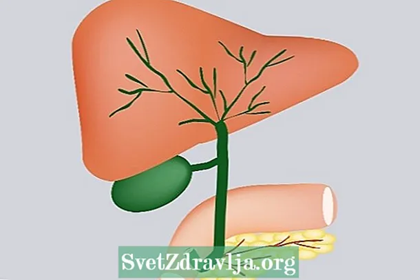 胆管炎：是什么，症状和治疗