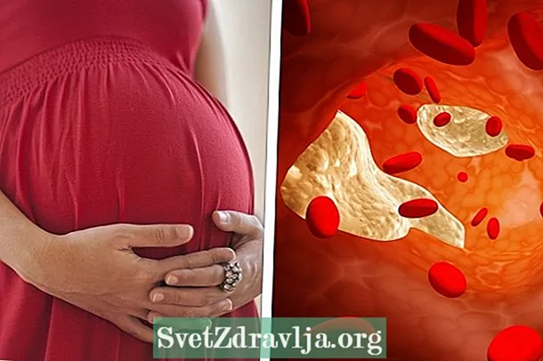Didelis cholesterolio kiekis nėštumo metu